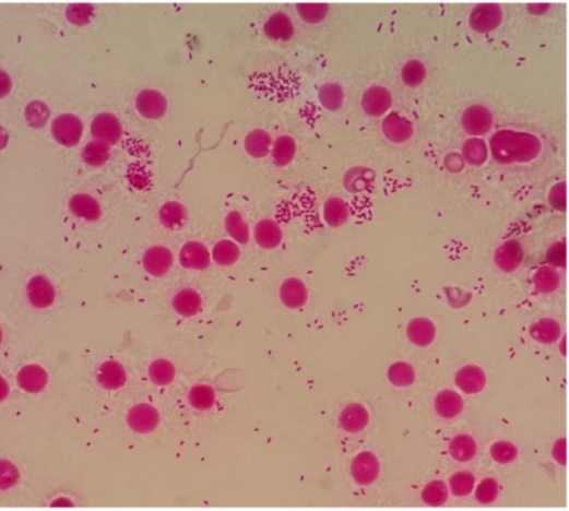 2ca6acc41a58cf5fba2645e0f21c8bb9