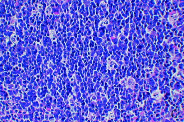 9e476d13b8c446f8340738a090af2d95