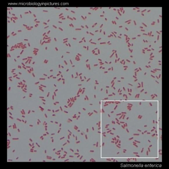 Salmonella. Gram stain and cell morphology. Salmonella micrograph, appearance under the microscope. Salmonella cell morphology. Salmonella microscopic picture. Salmonella enteritidis.