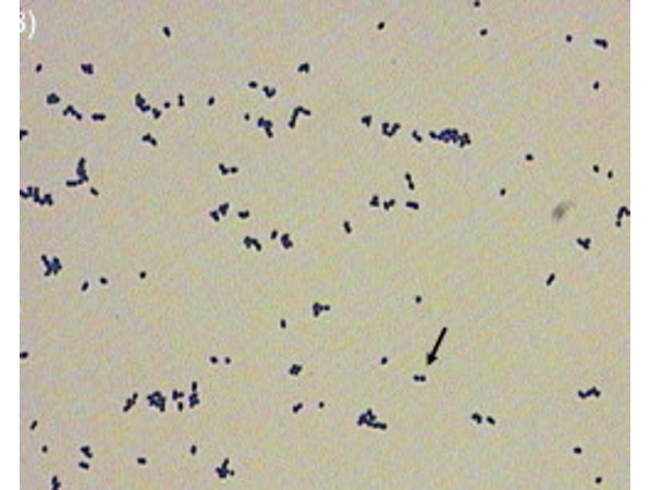 C:\Users\Administrator\OneDrive - Lo\桌面\病原微生物-李大鸿（图片）\病原微生物信息收集 李大鸿\病原微生物-李大鸿（图片）\解没食子酸链球菌\图1解没食子酸链球菌革兰氏染色照片.jpg